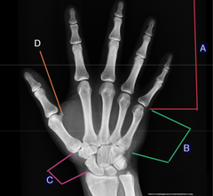 <p>B?</p>