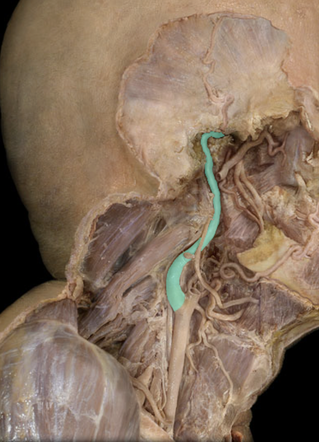 <p>Identify the artery of the head/neck/body cavities</p>