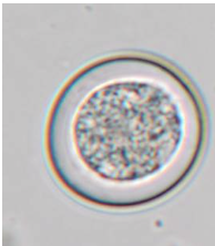 <p>~25um, from a 19 week old puppy</p>
