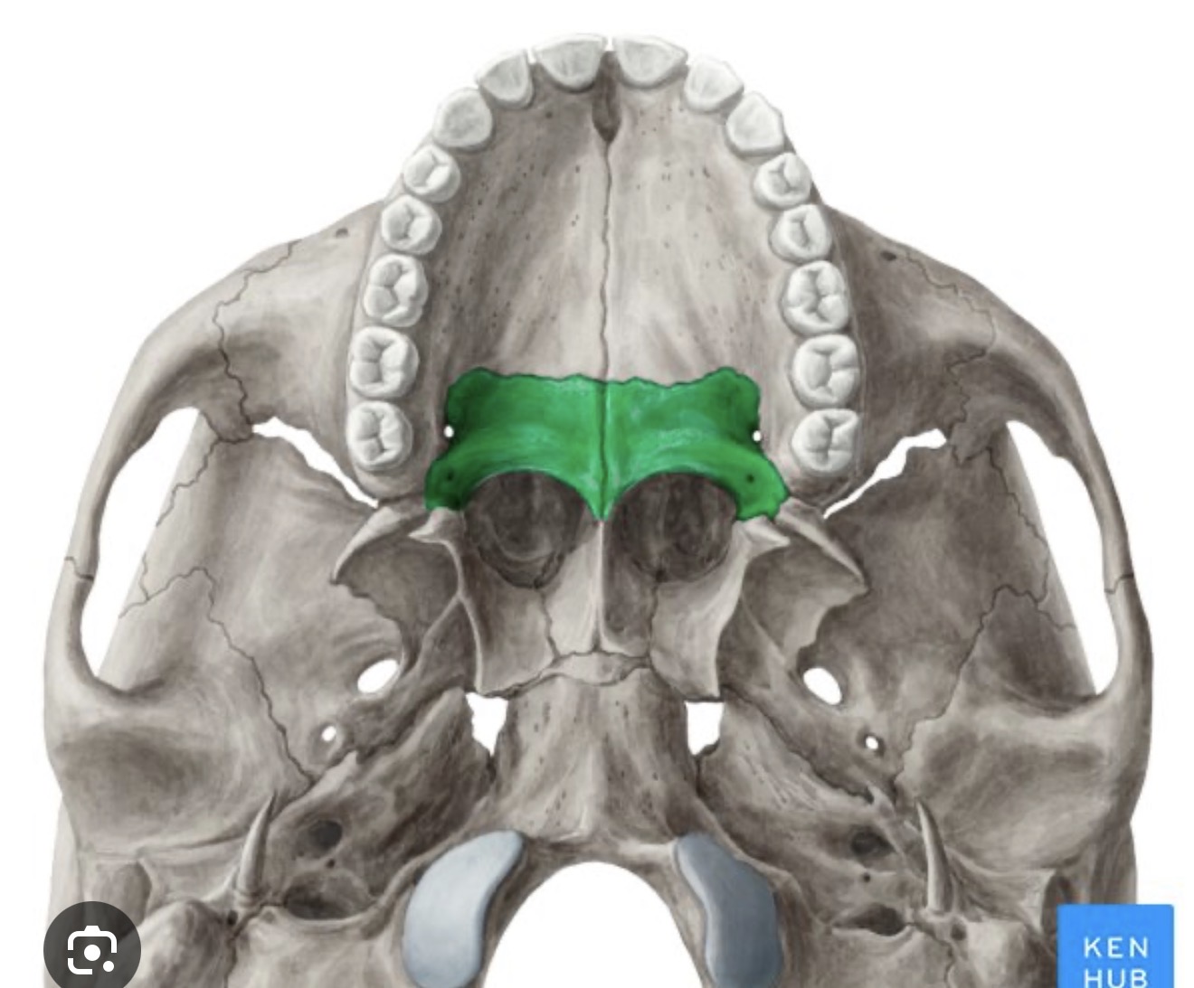 <p>what is this? R/L</p>