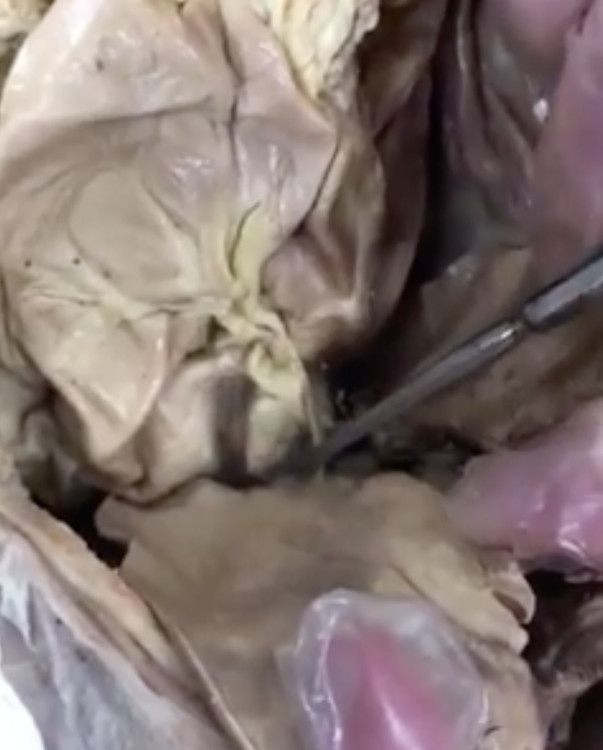<p>membrane under live that prong is touching</p>