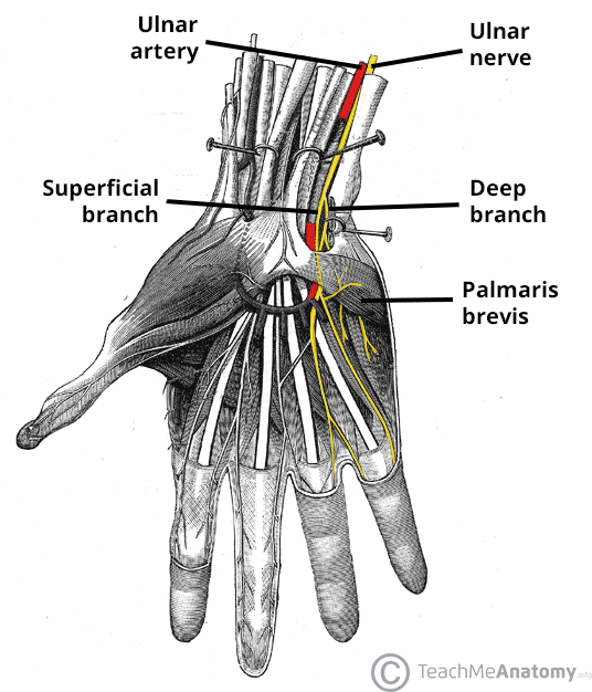 <p>The ulnar nerve is <strong>superificial to flexor retinaculum </strong>and <strong>runs with the ulnar artery. </strong>It is on top/diagonal to the artery around the palmar arterial arch. Cutaneous branches to <strong>digit 5 and the medial half of digit 4.</strong> Motor branches to all other<strong> intrinsic hand muscles. </strong></p>