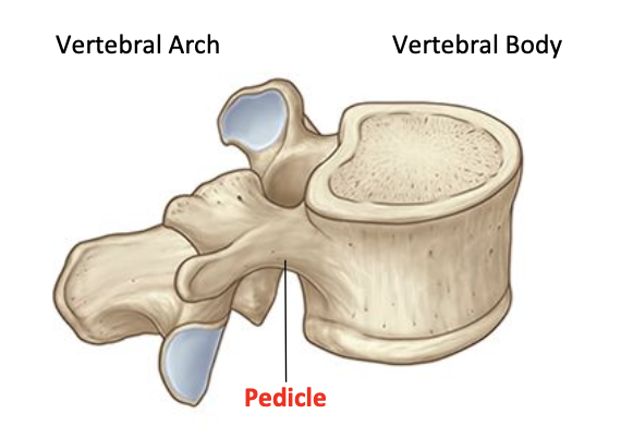 <p>Pedicle</p>