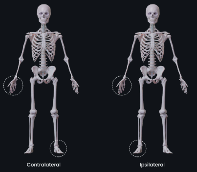 <p>ipsilateral = on same side of body/part, right pic</p><p>contralateral = on opposite side, left pic</p>