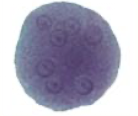 <p>What Amaeba is this?</p>