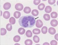 <p><span style="line-height: 17.375px;">Identify the white blood cell shown here.&nbsp;</span></p>