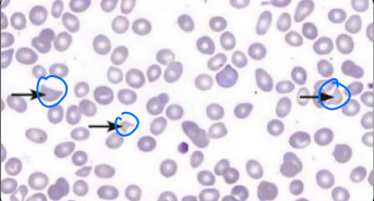 <p>what type of erythrocyte cell is this?</p>