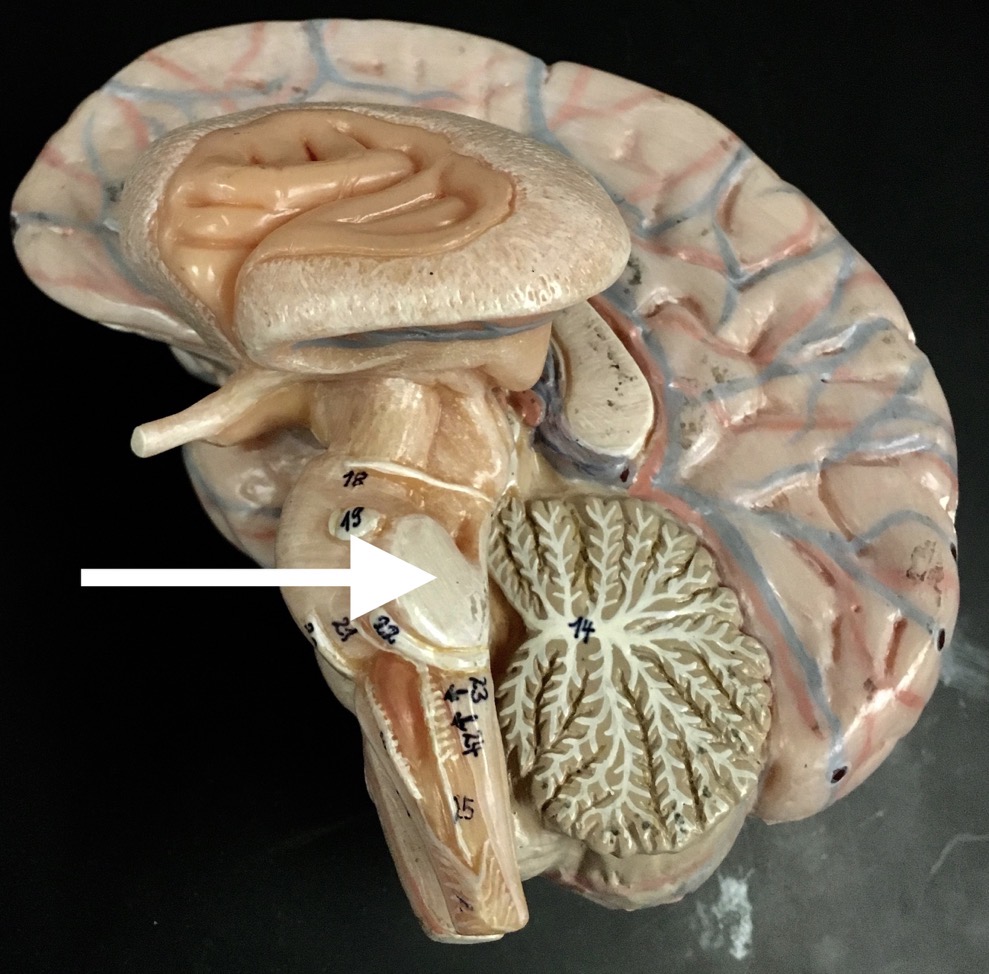 <p>What is the arrow pointing to?</p>