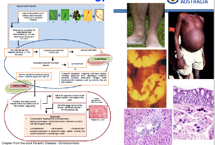 <p>Pathology of Schistosomiasis</p>