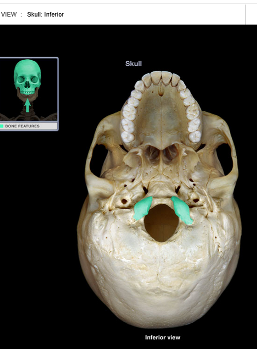 <p>Occipital condyle</p>