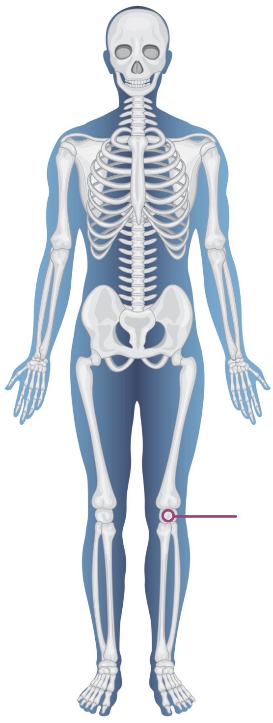 <p><strong>Name of bone + Type of bone</strong></p>