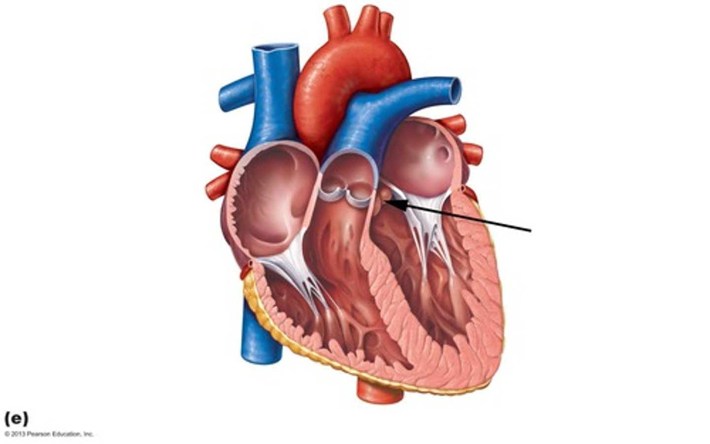 <p>aortic semilunar valve</p>