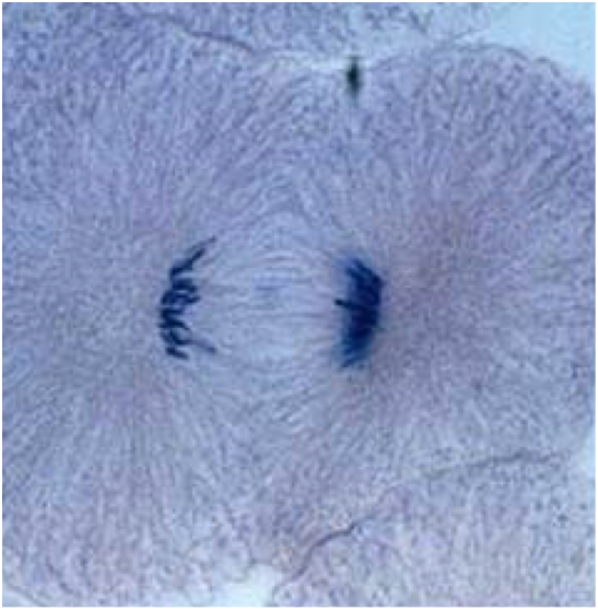 <p>What phase of mitosis is this?</p>