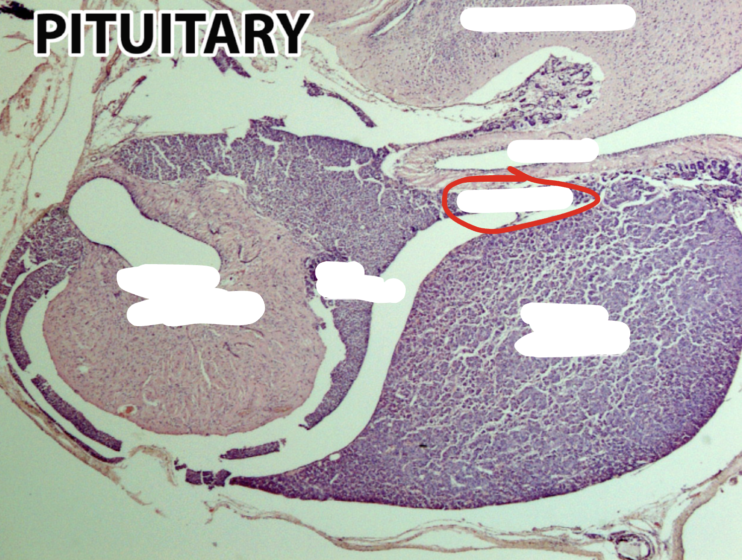 <p>What part of the pituitary is this?</p>