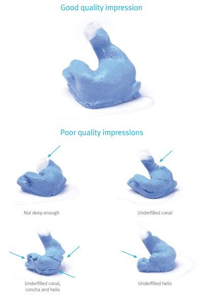 <p>inspecting the impression, key criteria: </p>