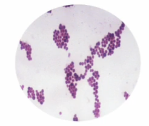 <p>what bacteria shape is this?</p>