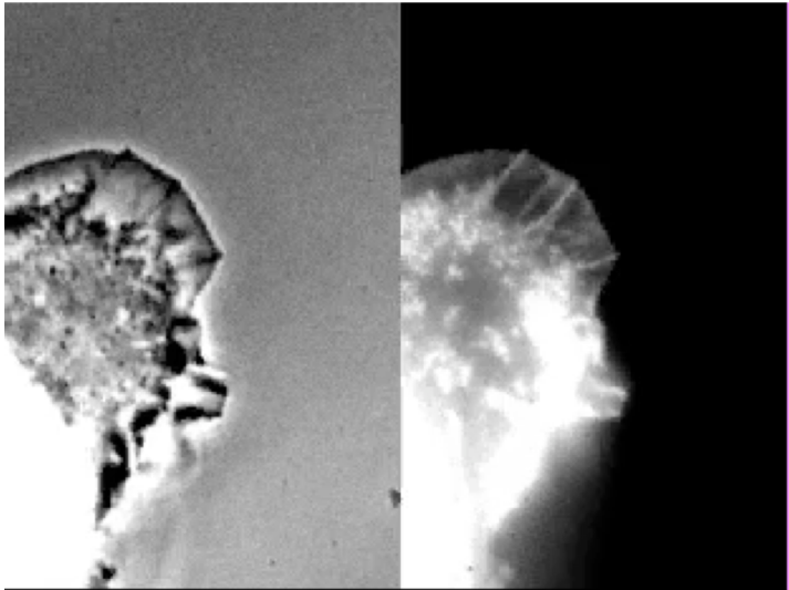 <p><strong>Fluorescence speckle microscopy</strong> = live-cell imaging technique using very low [fluorescently-labeled subunits] → “speckle” pattern</p><ul><li><p>Visualize retrograde flow </p></li><li><p>Meshwork pushed backwards as membrane = moving outward</p></li><li><p>Membrane → resistant </p></li><li><p>Pushes meshwork inwards </p></li></ul><p></p>