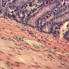 <p>En el intestino delgado, en la capa histológica de la submucosa, que estructura <strong>controla las secreciones glandulares, la absorción y movimientos locales</strong>. ¿Cuál es?</p>