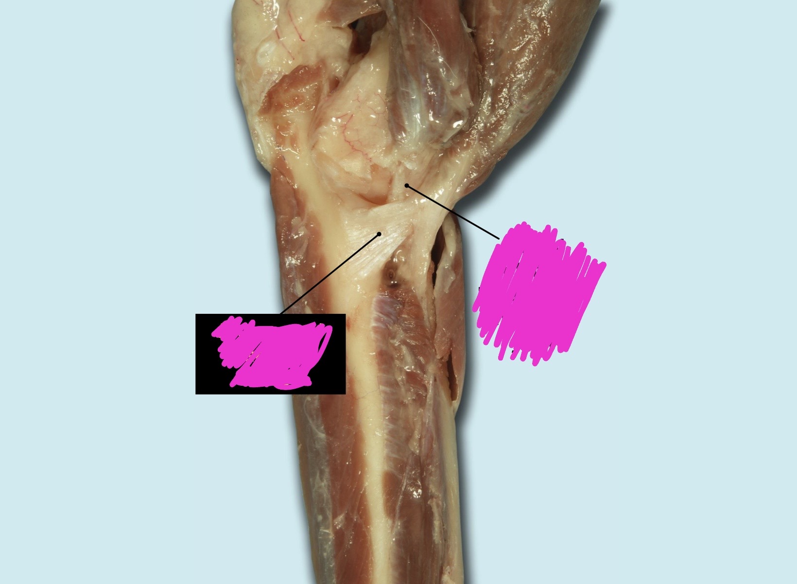 term image
