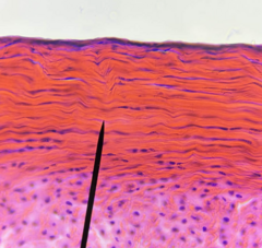 <p>What kind of tissue is this?</p>