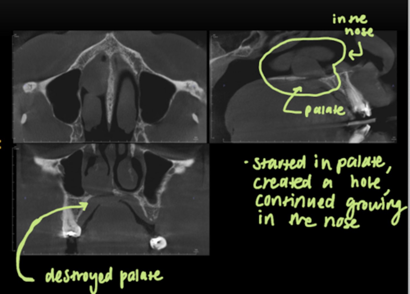 <p>Palate</p>