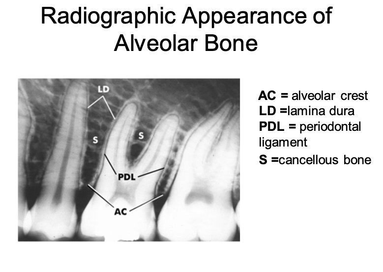 <ul><li><p>That portion of the maxilla and mandible that forms and supports the alveolar housing (sockets of the teeth).</p></li><li><p class="p1">Constant remodeling: activity of osteoblast and osteoclast.</p></li><li><p class="p1">The least stable of the periodontal structures due to its constant state of flux</p></li><li><p class="p1">Osteoid: newly deposited, nonmineralized bone matrix</p></li><li><p class="p1">Bundle bone: bone adjacent to the PDL that contains the Sharpeyās fibers. Inner layer of alveolar bone proper (lamina dura)</p></li><li><p class="p1">Periosteum: connective tissue layer covering outer surface of the bone</p></li><li><p class="p1">The bone height is within 2 millimeters of the CEJ</p></li></ul><p></p>