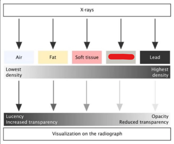 <p>what is it (Intro to Diagnostic Imaging)</p>