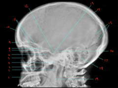 <p>What sinus is labeled 18?</p>