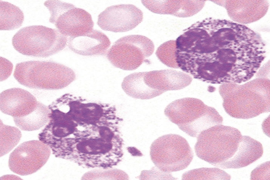 <p>what are the characteristics of the alder-reilly anomaly?</p>