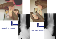 <p>kVp: 60-75</p><p>Grid: No</p><p>CR: directed midway between malleoli</p><p>Patient position: supine, legs fully extended, dorsiflex foot near right ankle lower leg as far as possible, then plantarflex and laterally bend as far as possible</p><p>Evaluation criteria: Distal aspect of tibia and fibula demonstrated and Ankle joint to center of collimation field</p>