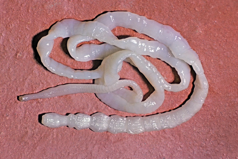 <p>Tapeworm</p>