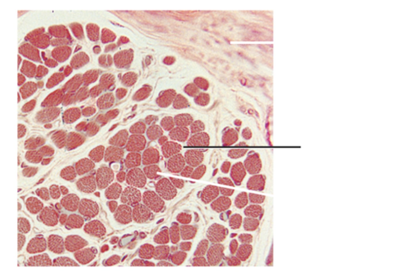 <p>thin connective tissue surrounding each individual muscle fiber</p>