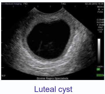 <p>thick walled, more than 3 mm thick</p><p>single cysts</p><p>produces mainly progesterone </p>