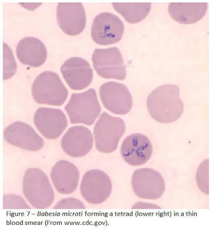<p>Symptoms of Babesiosis</p>