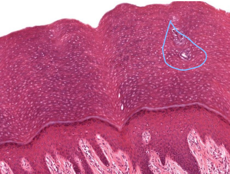 <p>What is circled here?</p>