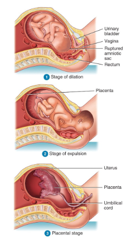 <ol start="2"><li><p>Stage of dilation</p></li><li><p>Stage of expulsion</p></li><li><p>Placental stage</p></li></ol><p></p>