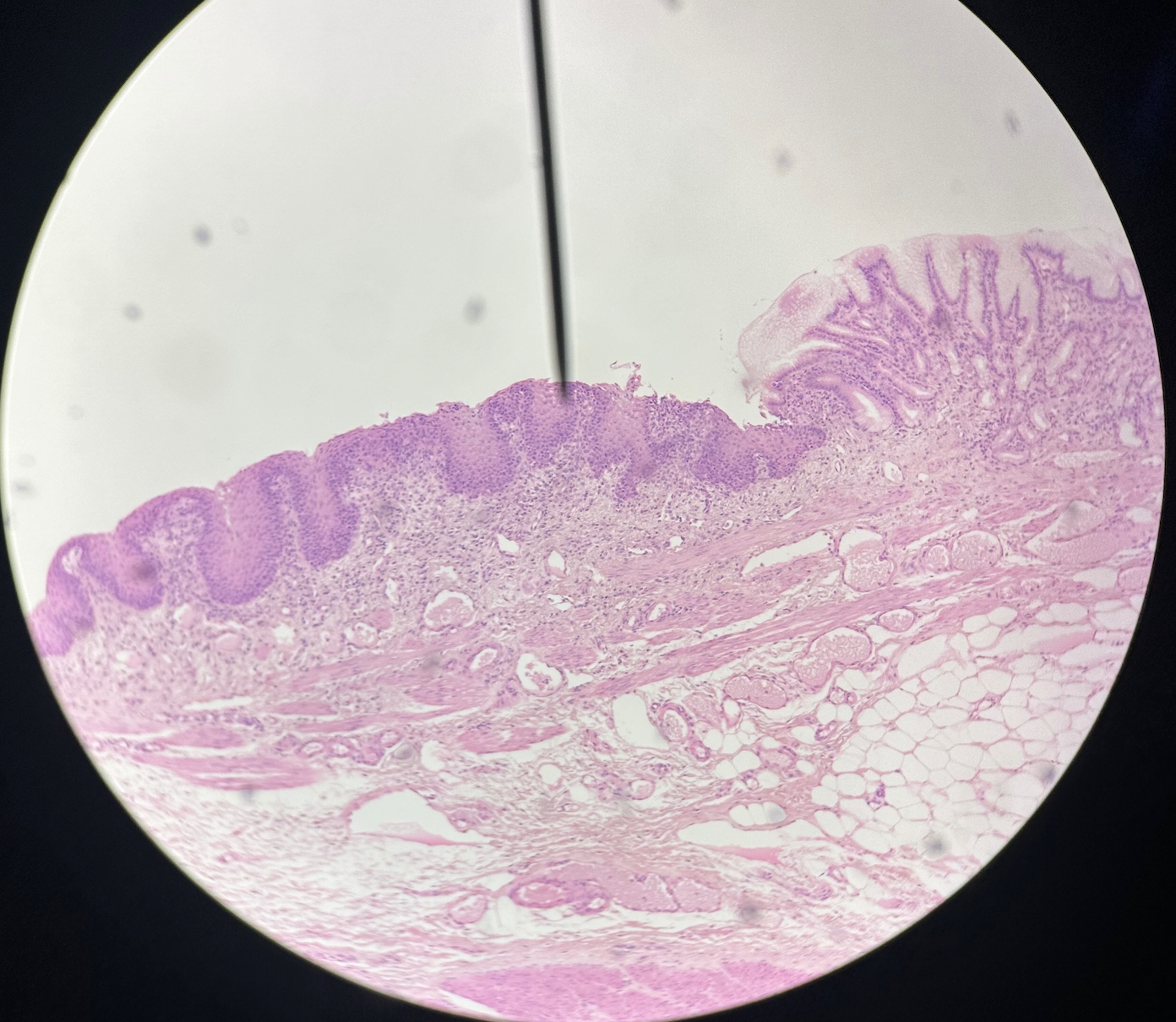 <p>Identify this tissue</p>
