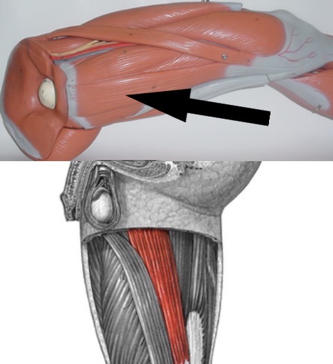<p>What muscle is this?</p>