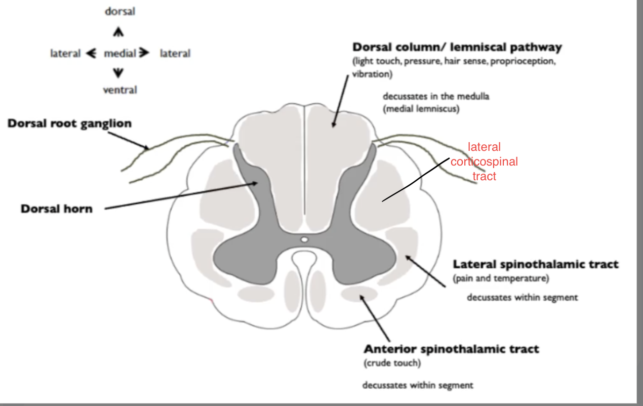 <p>Spinal Cord</p><ul><li><p>____ ____ </p><ul><li><p>light touch, pressure, vibrations, proprioception aka being aware of body’s location</p></li></ul></li><li><p>_____ spinothalamic tract - pain and temperature</p></li><li><p>____ spinothalamic tract- crude touch</p></li></ul><p></p><p></p><p>dorsal - _____</p><p>ventral - ____</p><p>RMBR: dorsal fin of orca is the TOP fin, ventral is BOTTO</p>