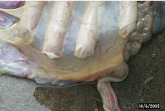 <p>What is happening in this placenta? (the little "concretions")</p>