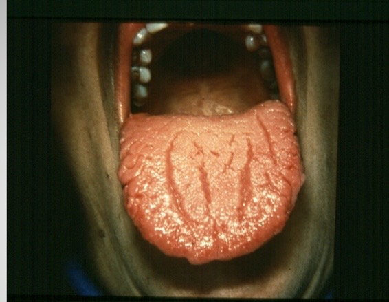 <p>What is this condition?</p>