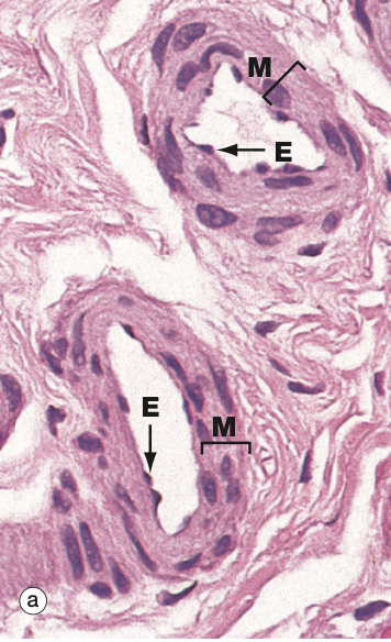 <p>Identify the Vessel and the Layer pictured</p>