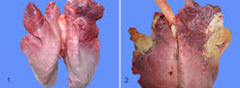 <p>This bovine respiratory bacteria causes purulent bronchopneumonia, fibrinous areas in lungs and bronchioles, and limited pulmonary necrosis</p>