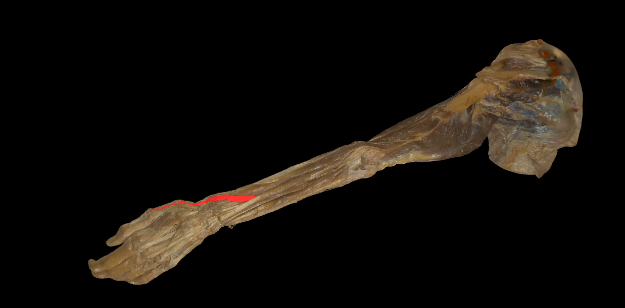 term image