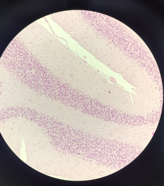 <p>Cerebellum - HE</p><ul><li><p><strong>Organization:</strong> <strong>Gray matter outside</strong>, <strong>white matter inside</strong>.</p></li><li><p><strong>Layers:</strong> Contains <strong>three layers</strong> of cells.</p></li><li><p><strong>Key Cell:</strong> Features large <strong>Purkinje cells</strong> (referred to by the professor as "protein cells")</p></li></ul><p></p>
