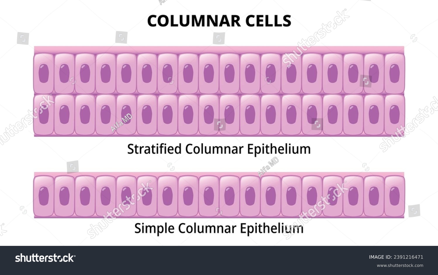 <p>Taller than wide</p><p>Found in: inner lining of stomach and instestines </p>