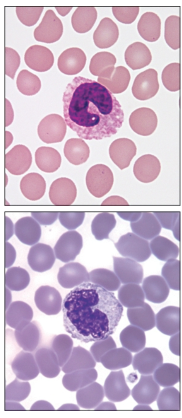 <p>Agranulocytes—<strong>monocytes</strong></p><ul><li><p>3–8% of all blood leukocytes</p></li><li><p>Roughly two times the size of RBCs</p></li><li><p>Bluish-gray cytoplasm in most stains with an indented/irregular nucleus shape</p></li><li><p>Blood form of tissue macrophages</p></li><li><p>Can be phagocytic and antigen-presenting cells for induction of immune responses</p></li></ul><p></p>