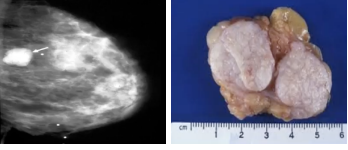 <p>What pathology?</p>