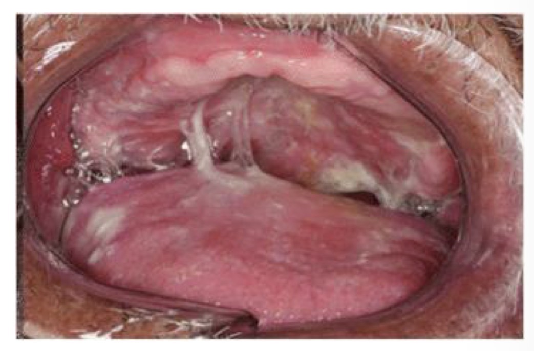 <p>CHẨN ĐOÁN?</p>