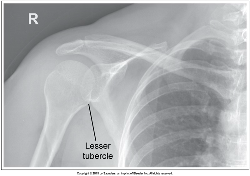 <p>AP internal shoulder</p>